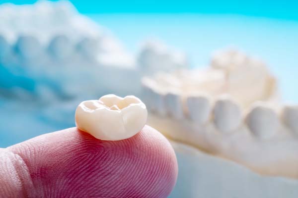 The Number Of Dental Visits For A Dental Crown
