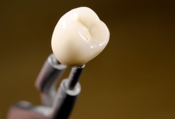 What Is A Dental Crown?