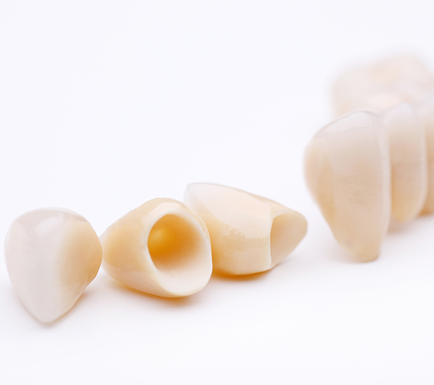 Northvale Dental Crowns and Dental Bridges
