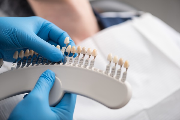 The Process Of Getting Dental Veneers: What To Expect