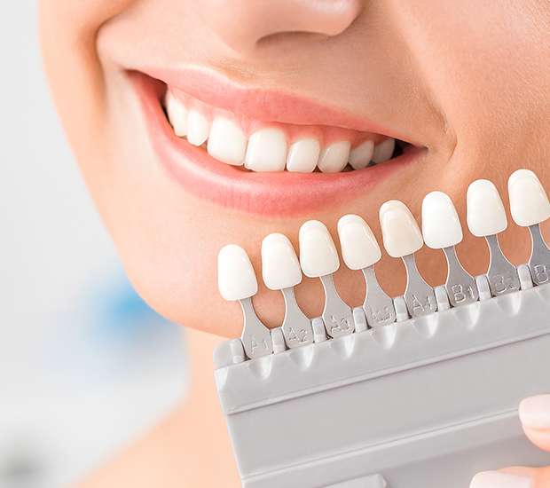 Northvale Dental Veneers and Dental Laminates