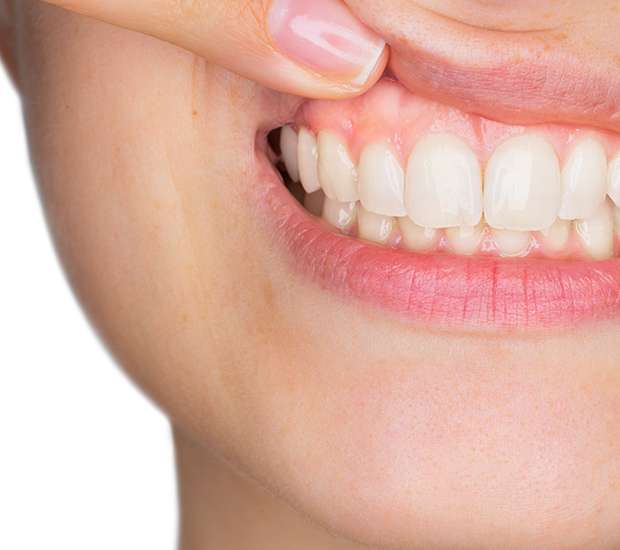 Northvale Gum Disease