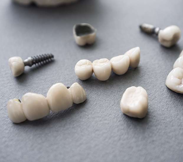 Northvale The Difference Between Dental Implants and Mini Dental Implants
