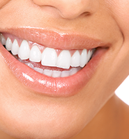 Teeth Whitening Services Northvale, NJ