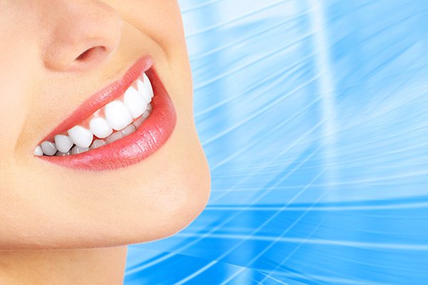 What Causes Porcelain Veneers To Fail?