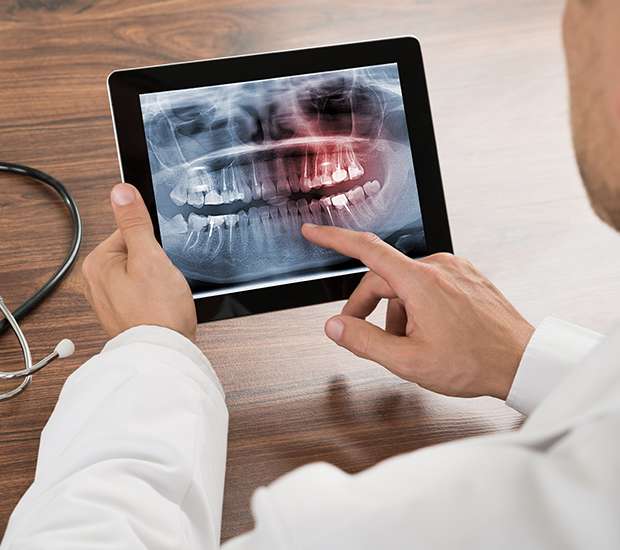 Northvale Types of Dental Root Fractures